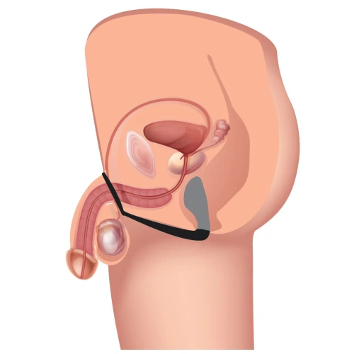 Prostatic Play Explorer II Prostate Stimulator And Cock Ring - Стимулятор простати, 8,8х3,1 см (черный)